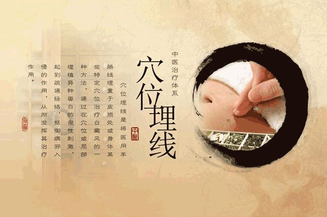 現(xiàn)代念佛拍手養(yǎng)生法，獨(dú)特的健康之道探索